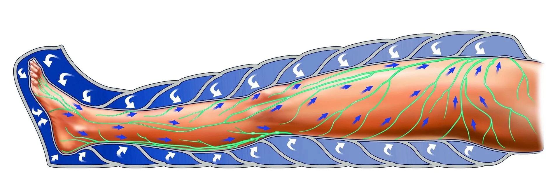Прессотерапия