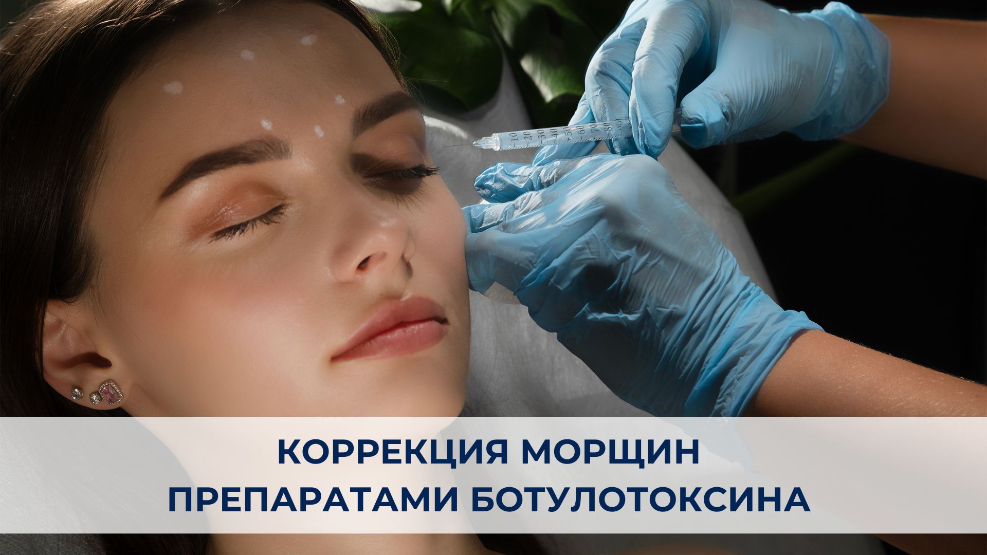 Коррекция морщин препаратами ботулотоксина .jpg