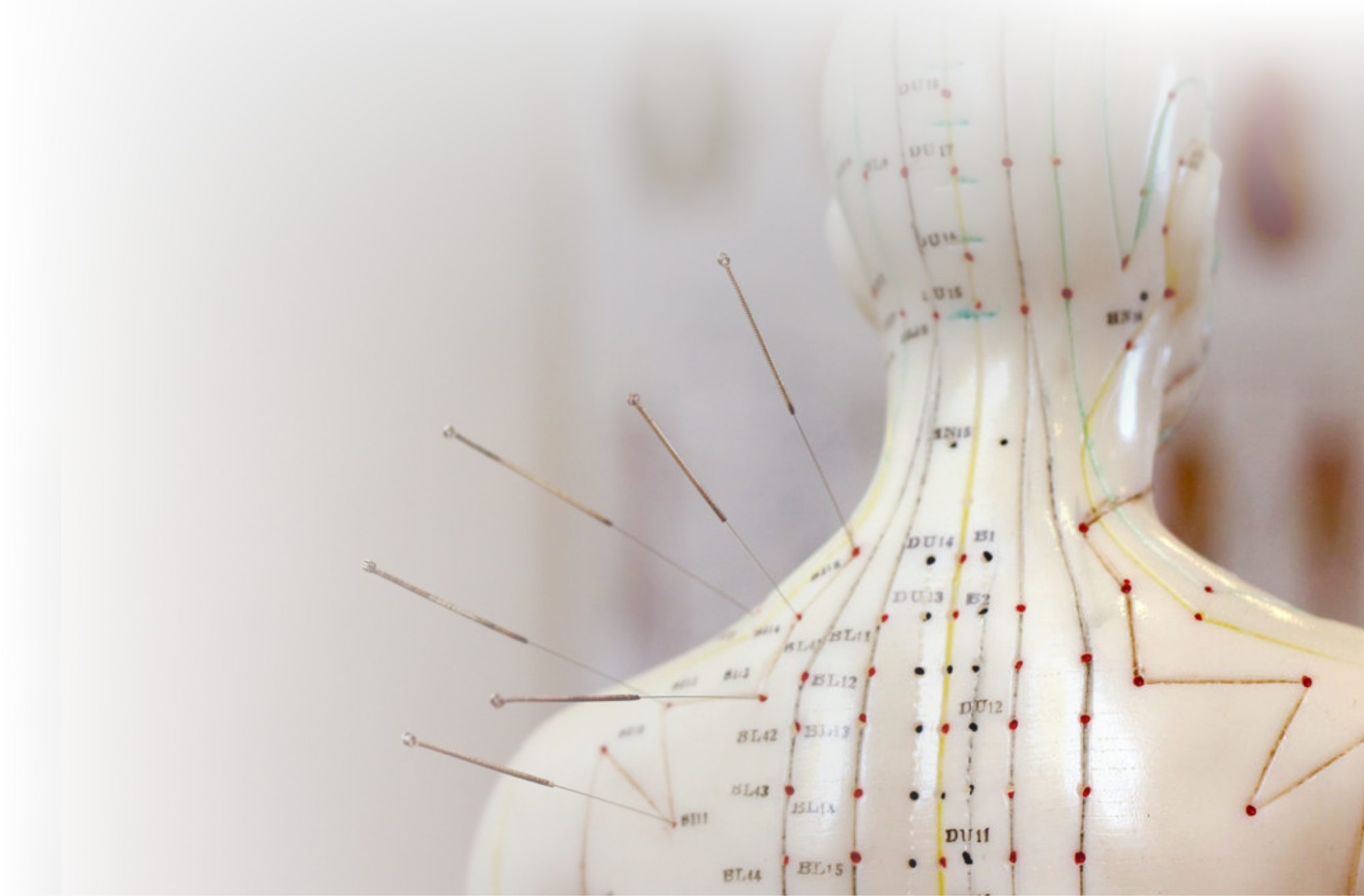 Рефлексотерапия