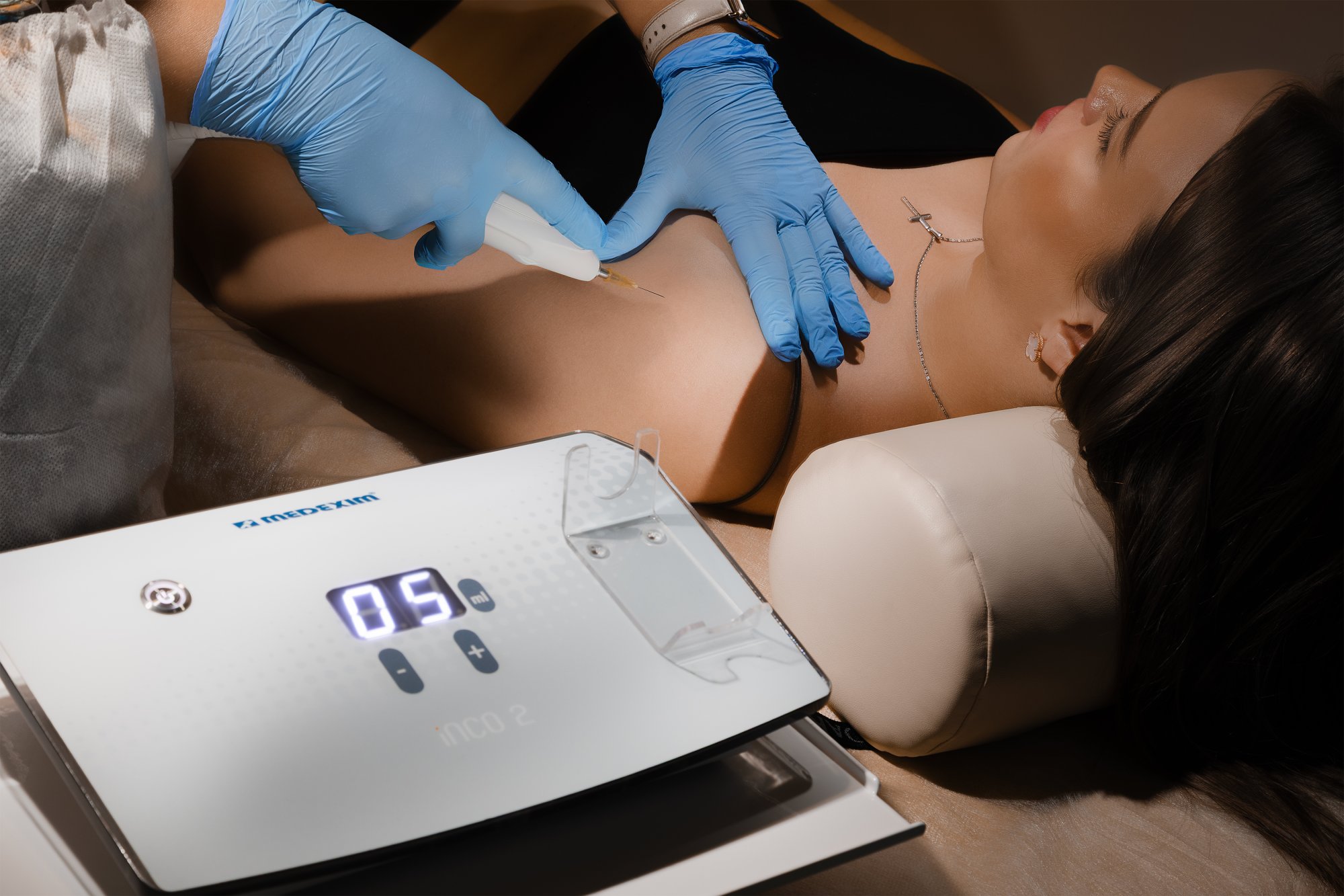 Карбоксирефлексотерапия