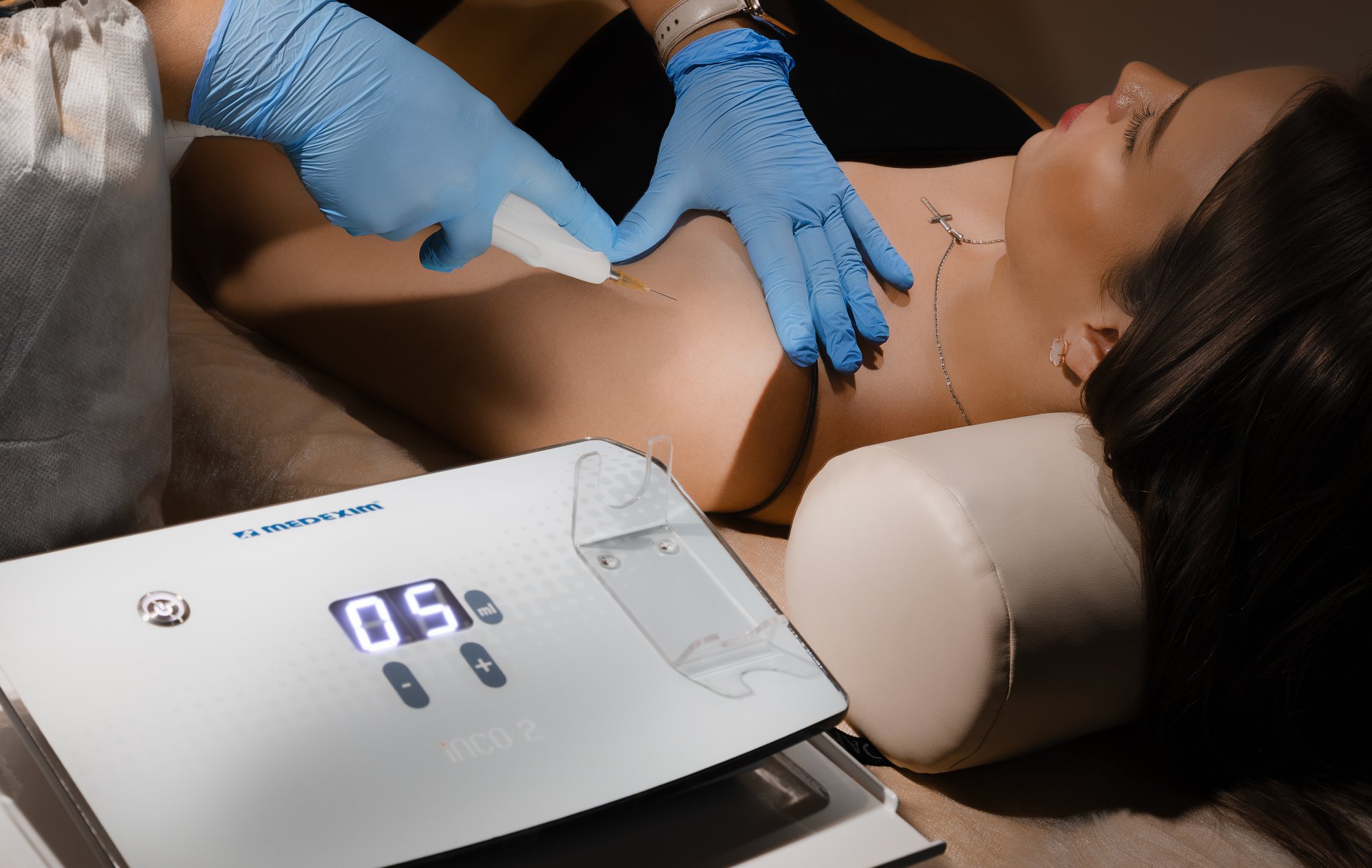 Карбоксирефлексотерапия